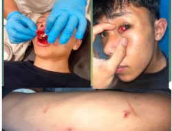Kasus Pengeroyokan di Simpang Pujes Sidikalang, Polres Dairi Tetapkan 4 Tersangka